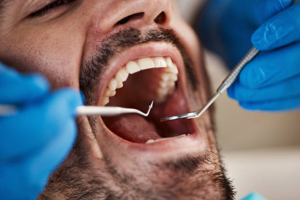 Best Emergency Dental Surgery in Harlan, IN